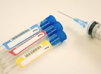 犬の健康診断血液検査の結果